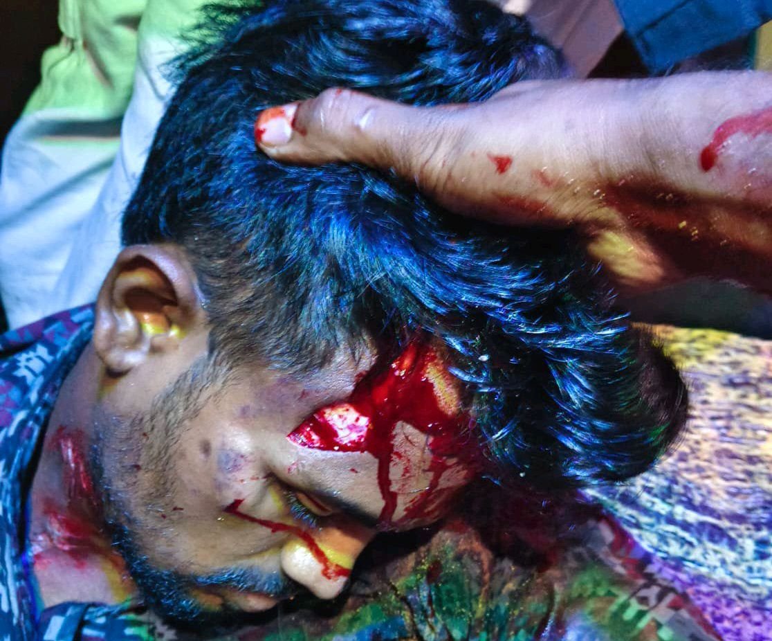 డీజే వాహనం ఢీకొని యువకునికి తీవ్ర గాయాలు