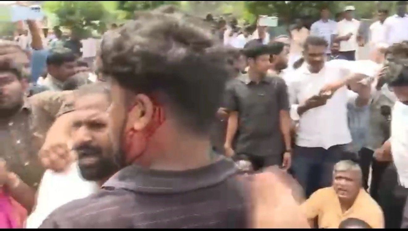 శాప్ కార్యాలయం వద్ద  యువకుడి తలపై లాఠీతో దాడి